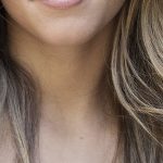 Povećana štitnjača može biti uzrok nedostatka hranjivih tvari u organizmu,